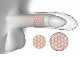 Increase in penis in volume